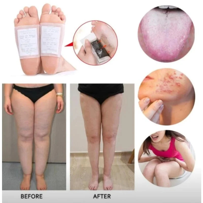 Parche Detox para Pies Kinoki